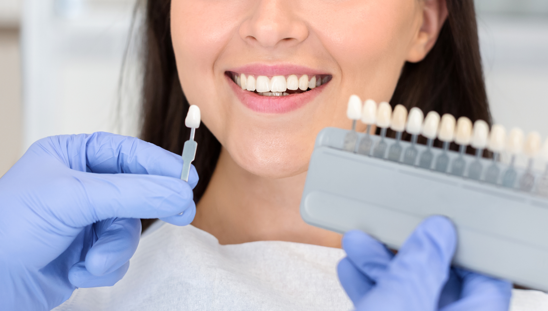 Dentist in blue medical gloves applying sample from tooth enamel scale to happy woman patient teeth to pick up right shade, teeth bleaching procedure, cropped, panorama